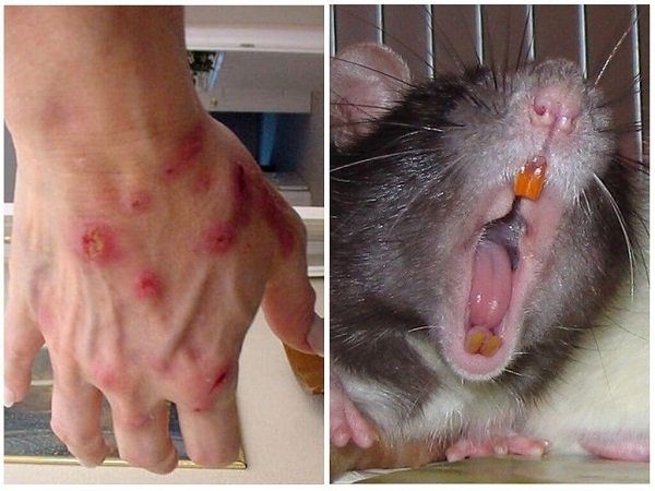 Роли крыс как переносчиков опасных заболеваний